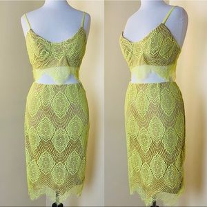 L’ATISTE Neon Yellow Lace Overlay 2 Pcs Set Large